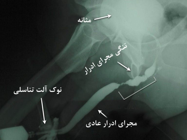 عکس RUG چیست و چگونه انجام می شود؟ عوارض و هزینه
